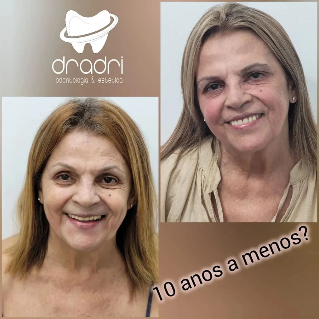 Harmonização 2