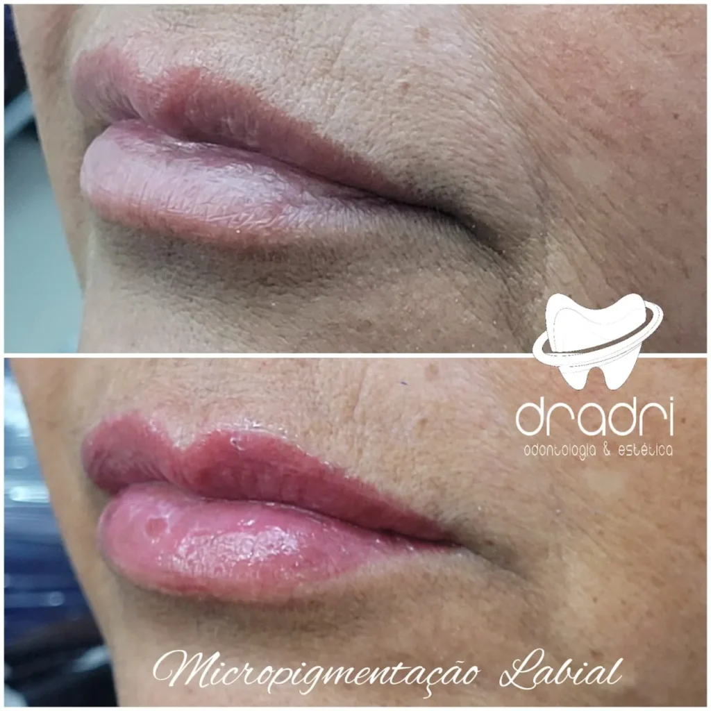Micropigmentação Labial